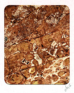 collograph_bark_texture2